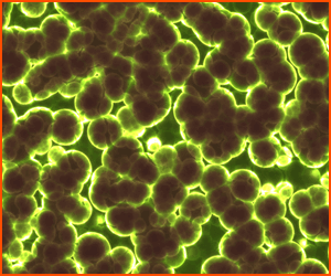 善玉菌と悪玉菌の違いと正しい知識